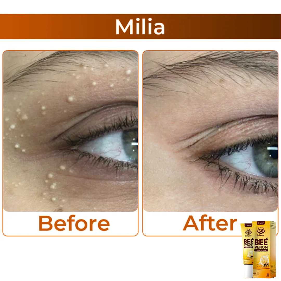 سم النحل + الكولاجين: أحيي نظرتك 