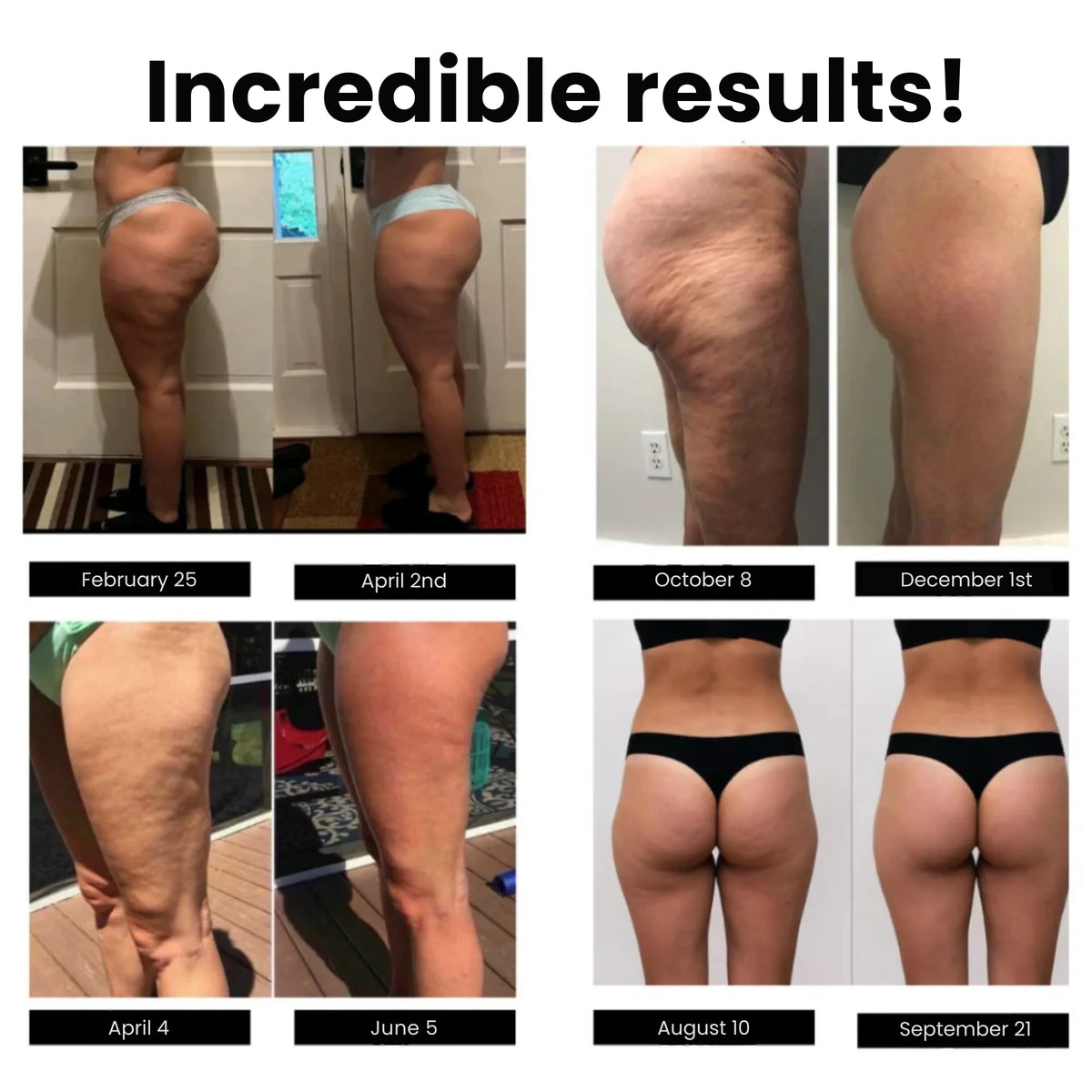 Leggings anticelulíticos — foto 4